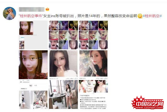 网友曝桂林航空事件女主旧照 疑“换头式”整容 