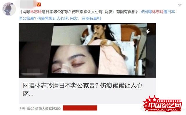 不能生育遭老公家暴离婚？林志玲七夕晒照否认